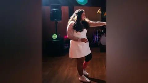 Shannon Mitchell Shannon Mitchell dances at her wedding reception while smiling widely and gesturing to someone who is not in the picture. She is wearing a short white dress with white high-top trainers. Her decorated prosthetic leg cover can be seen.