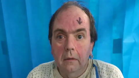 Toni Woodward Toni in a hospital gown with an arrow pointing towards his right eye. He is getting ready for an eye transplant.