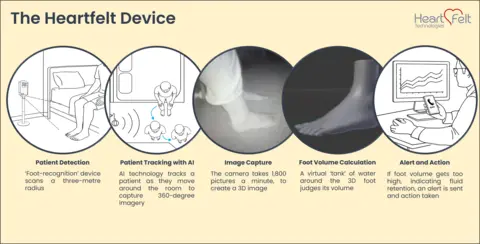 Heartfelt Technologies Diagram of a medical device system for monitoring patients. It includes a 'foot-recognition' scanner with a three-metre detection radius, AI-powered patient tracking for 360-degree imagery, a high-speed camera capturing 1,800 images per minute to create a 3D model, and a virtual water tank used to calculate foot volume. If the volume exceeds a threshold, an alert is triggered for medical intervention.