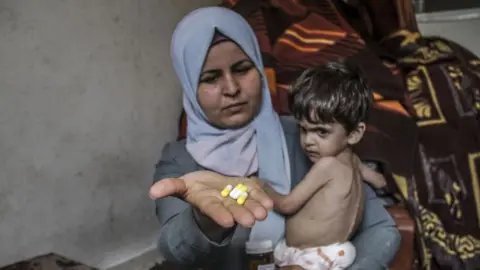 Getty Images Mother with malnourished three-year-old child in Gaza City, Gaza