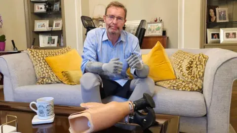 MICHAEL KEOHAN Craig Mackinlay sat on a sofa with his prosthetic legs on a table.