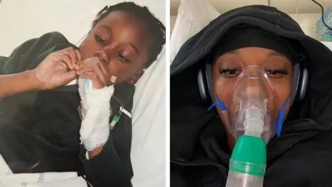 Abi Osei-Mensah A split screen composite. In the left image, Abi as a child wears a dark green school uniform, lying on a hospital bed, with her left hand bandaged around a cannula. In the right, an older Abi lies on a hospital bed with headphones and a black hood over her head and oxygen mask over her mouth.