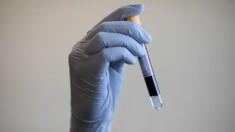 A paramedic holding a test tube containing a blood sample.