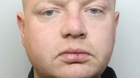 A close-up of a man's face. He has cracked lips, and is looking directly at the camera. He is wearing a dark top. 