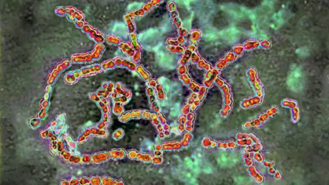 Getty Images A microscopic picture of Group A Streptococcus bacteria. Long red strips that almost resemble worms are scattered across a green backround. 