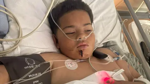 Family A boy in a hospital bed, hooked up to wires and drips. His bed is inclined up so his head is raised. He has dark brown hair and a large cut can be seen on his chin and other smaller ones on his face.