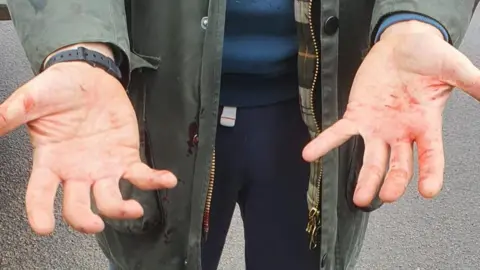 Eddie Reeves A man's hands, stained with blood, are held open in front of the camera.