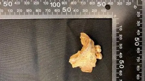 A piece of jaw bone with two teeth lies on a black cloth alongside ruler measurements denoting its size.