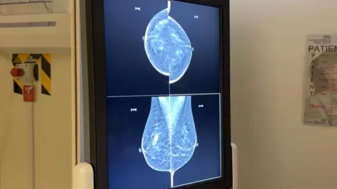 Results from a breast screening (mammogram) shown on the screen at a mobile breast screening unit in Ashbourne, Derbyshire.