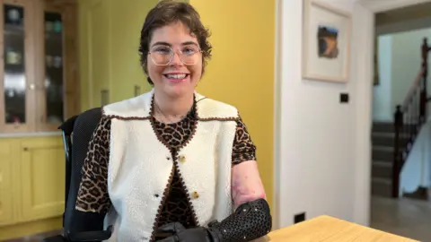Lily is seated at a wooden table indoors using a powered wheelchair, wearing patterned clothing and a cream vest, with a black robotic prosthetic arm resting on the table.
