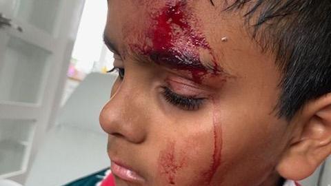 Talha Hussain with blood from cuts on his face