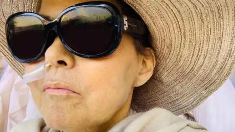 Caroline King Wearing sunglasses and a wide-brimmed hat, Caroline sits in hospital with a feeding tube in her right nostril. While she awaits a liver transplant, her skin is a clear shade of yellow.