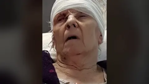 Family handout Lily Rawson injured in hospital