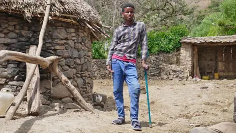 Amensisa Negera / BBC Berhane Haile, now 17, wearing a checked shirt stands outside a stone and thatched house in Seyabo. He is leaning on a crutch