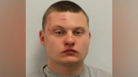 Met Police A mugshot of a man with facial wounds looking at the camera