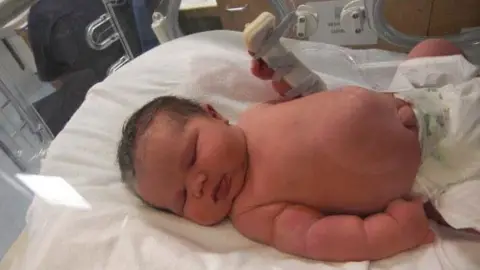 Family handout Baby sleeping in an incubator 