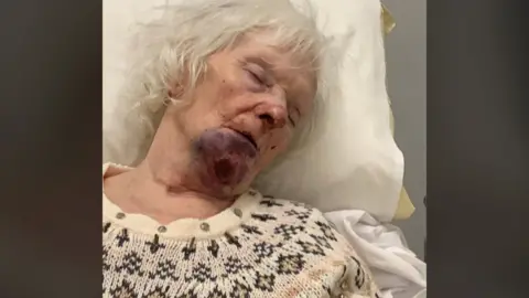 Family handout Lily Rawson in a hospital bed with facial injuries