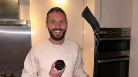 Adam holding a signed puck and a signed hockey stick smiling with steristrips on his forehead covering his cut