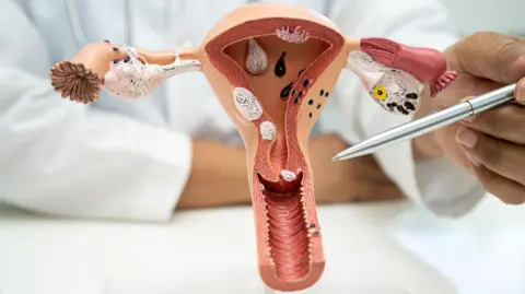 Getty Images A doctor demonstrating on a plastic anatomical model where the cervix is in the female reproductive system.