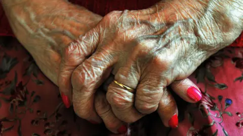 An elderly woman's hands folded over each other. She is wearing pink nail varnish.