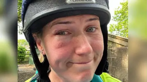 Becci Image of Becci wearing a riding hat and grimacing into the camera. Her eyes are bloodshot and she had a large bruise forming under her right eye. 