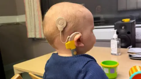 NUH Jasper Carver with his cochlear implant