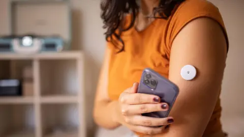Getty Images 年轻的糖尿病患者在家中使用远程传感器监测血糖水平，她的手臂上有一个血糖监测仪。