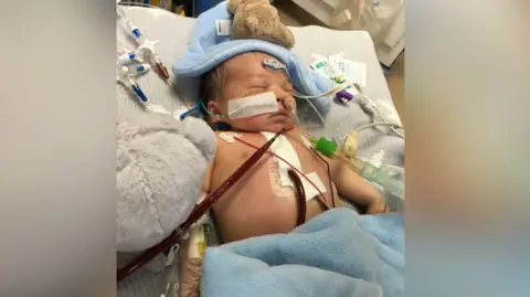 Handout Nate following one of his surgeries