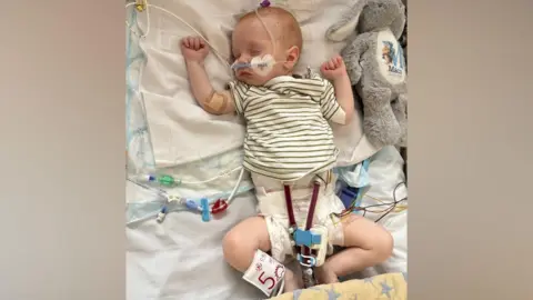 Family Photo Macs Green is a small baby. He is lying in a hospital bed with tubes coming from his face and body.