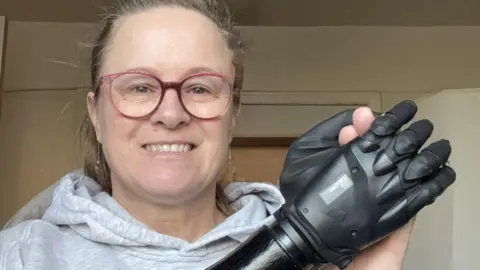 Julie Griffin has long brown hair tied back in a ponytail. She is wearing glasses, a grey hoodie, is smiling, and holding her black prosthetic arm across her chest.