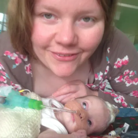 Helen Roper Helen is smiling, stood over her baby daughter in a hospital bed. Her baby Rumer has a breathing tube.