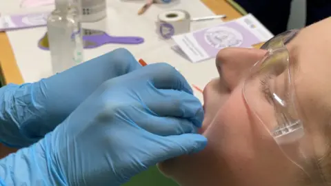 A dentist with blue rubber gloves puts treatment on a primary school child's teeth. The child is wearing clear protective goggles.