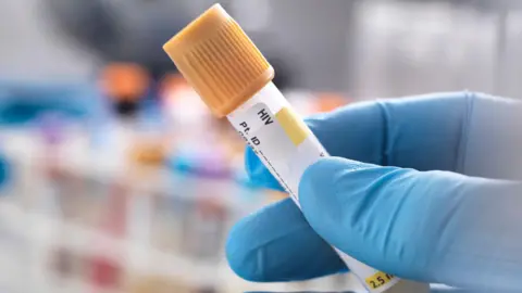 A stock image of a blue gloved hand holding a vial with HIV written on the label