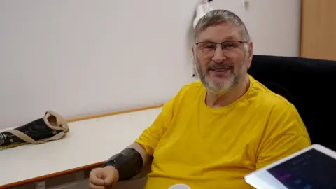 Rob Mannion, an older man with a grey beard wearing a bright yellow t-shirt. His left arm is a prosthetic, with a black forearm and a realistic light skin-coloured hand. On the table next to him is his old prosthetic, which has a beige strap. Rob is grinning.