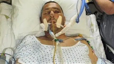 Submitted/George Pas George Pas wearing a white hospital gown and lying on a hospital bed in intensive care. He is hooked up to pipes and tubes going down his throat and up his nose. He is unconscious with swelling and bruising to his face.