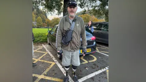 A man wearing a black cap who has grey facial hair. He is wearing a khaki zip jacket and black bag with grey shorts. He has two prosthetic legs