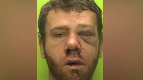 Nottinghamshire Police Police mugshot of an injured man