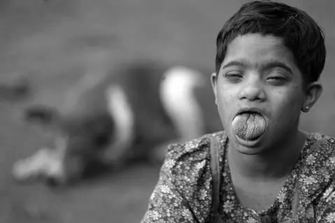 Madhuraj/Kochi Biennale Foundation Kavitha's mouth in open in the photograph, as her swollen tongue protrudes out.