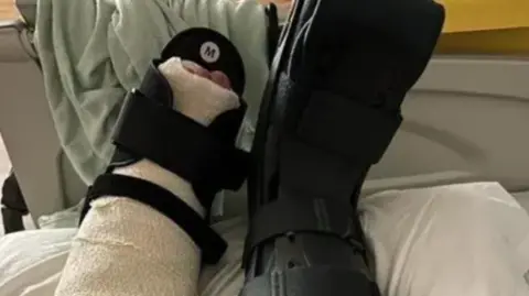 PA A  broken ankle wrapped in bandages and in a black boot