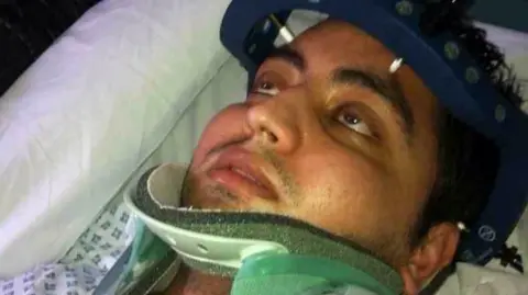 Ahsan is lying in hospital with a neck brace on.