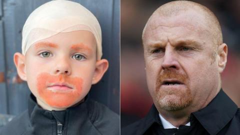 A composite image of Jacob dressed as Sean Dyche, alongside a picture of the Everton manager