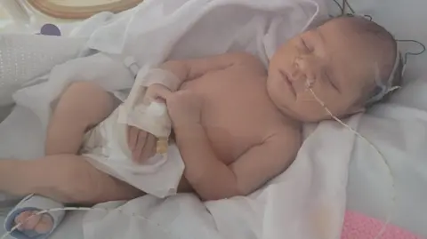 Contributed Amelia as a baby. She is laying down and has wires attached to her head and a feeding tube.