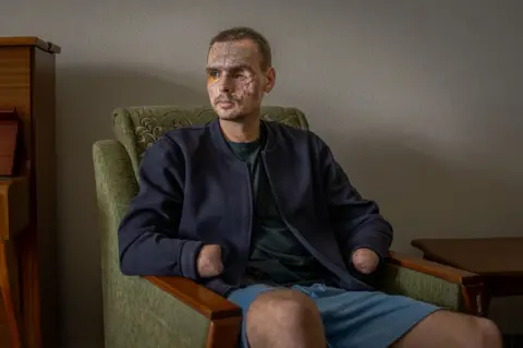 Nazar Bokhii sits in a green chair with dark blue jackets and light blue pants, a face is torn by an explosion