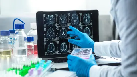 Getty Images Doctor wearing blue gloves pointing at screen showing scans of someone's brain at different angles.