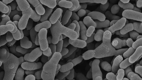 Wellcome Sanger Institute A black and white electron microscope picture of bacteria found in babies' guts 