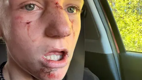 Jaime Owen A 12-year-old boy, with lacerations to his nose, under his eye and on his chin looks into the camera while sitting in the passenger seat of a car.
