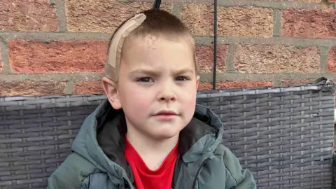 Kate Bradbrook/BBC A young boy with a bandage on his head. He is standing against a brick wall and wearing a green coat.