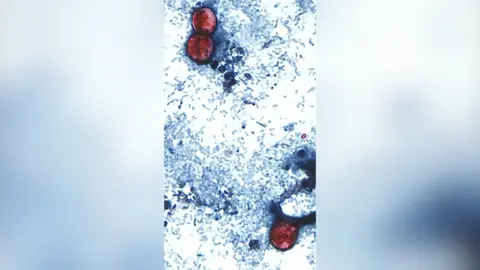 A close up picture of a parasite