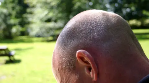 A close up of a man's head as he looks down while sitting in a park on a sunny day. He has very, very short grey, stubbly hair. A picnic bench and trees can be seen in the background.