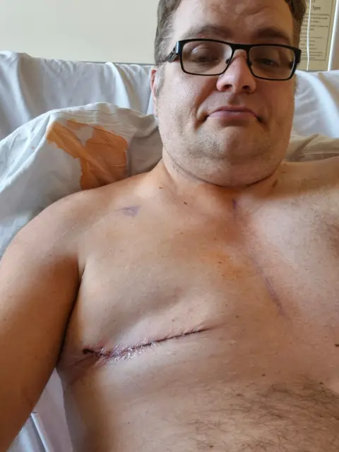 Neil Ferriby Neil Ferriby. He is topless and is propped up in a hospital bed. There is a red scar running horizontally across his right breast from the centre of his chest to under his armpit. His nipple has been removed. Neil has dark hair and wears glasses and is looking at the camera.